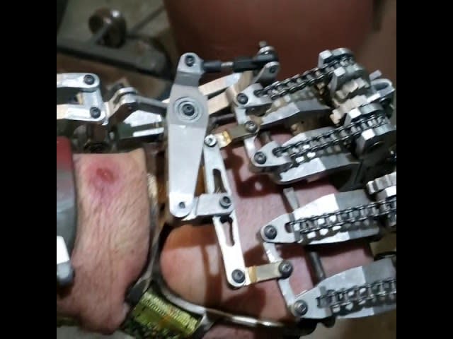 Mechanical prostetic Hand