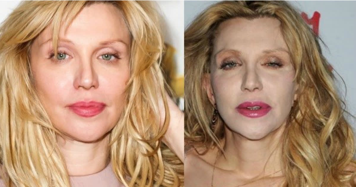 10 Hollywood Celebrities Whose Plastic Surgery Caused Them A Lifetime Embarrassment