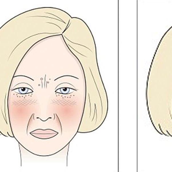 This is what wine, sugar, dairy and gluten actually do to your face...