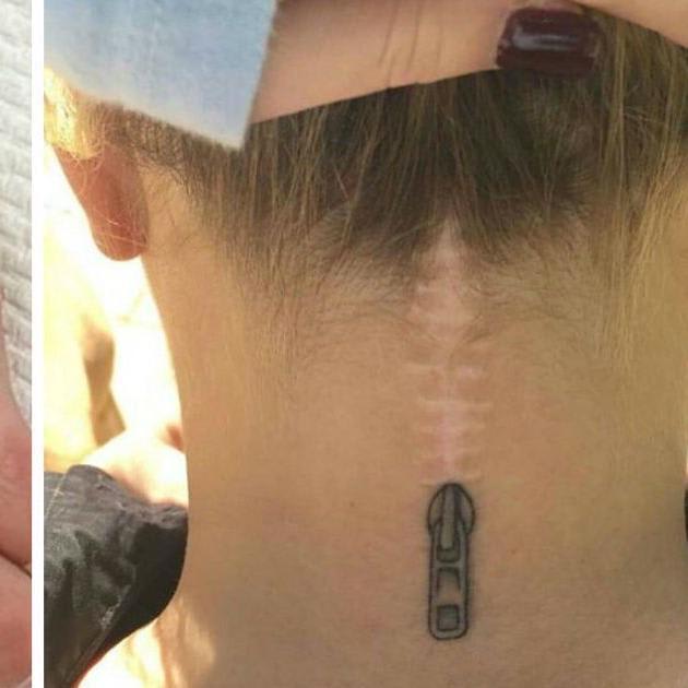Some Folks Try To Hide Their Scars, But These 9 People Are Turning Them Into Works Of Art