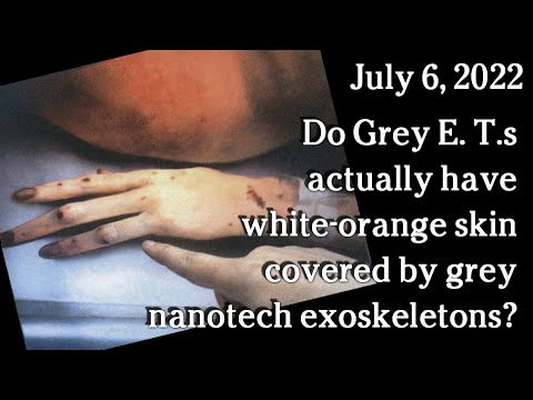 About the recent photos of a "Pink Alien Grey" shown by Linda Moulton Howe