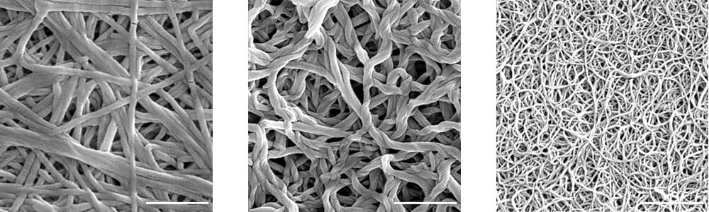 Study: The strength of collagen influenced by intersections of fibers
