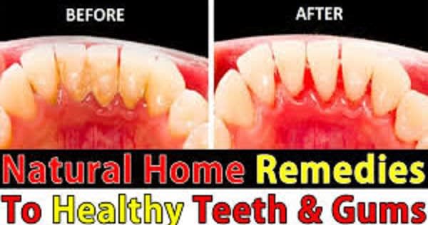 Are you suffering from sensitive teeth? Try these home made remedies for fast relief.