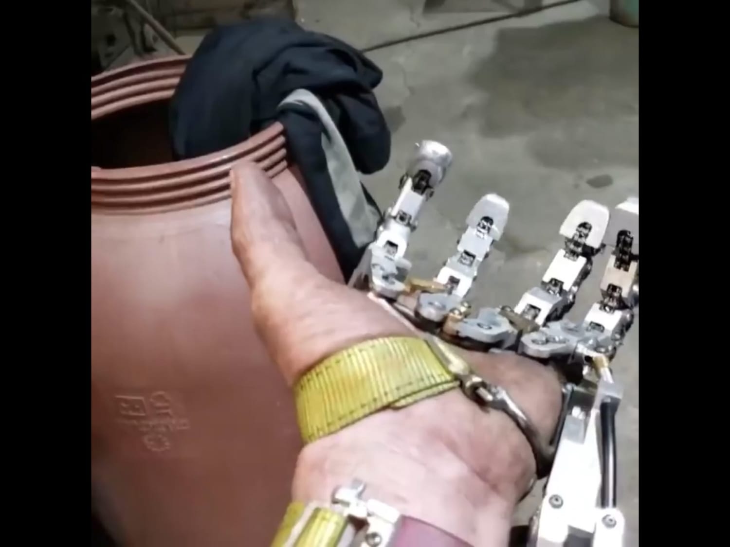 This finger prosthetic