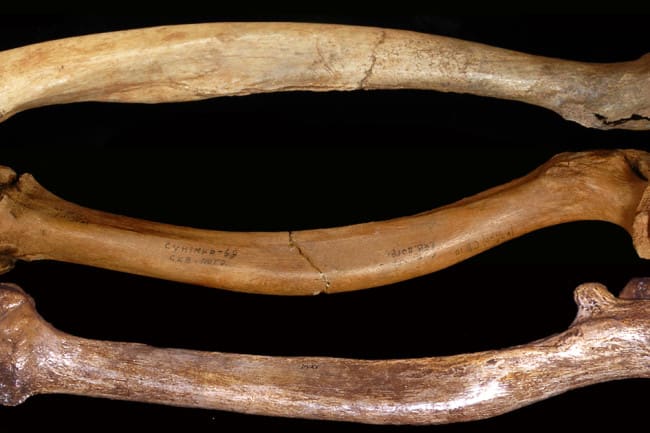 Inbreeding Was Common Among Early Humans, Skeletal Deformities Suggest