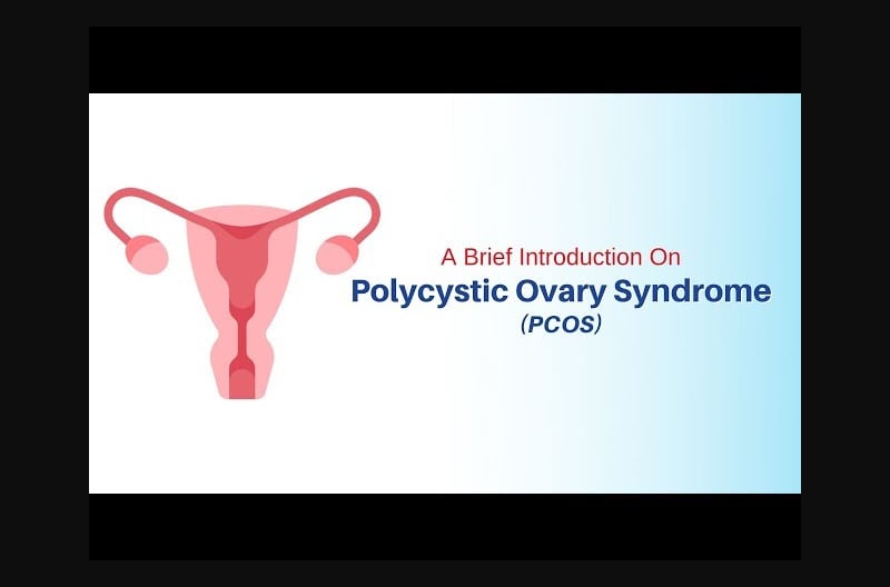 A Brief Introduction On Polycystic Ovary Syndrome PCOS