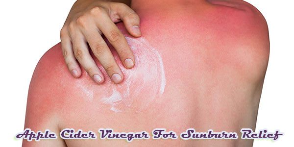 how to get rid of a sunburn overnight Fast Home Remedies