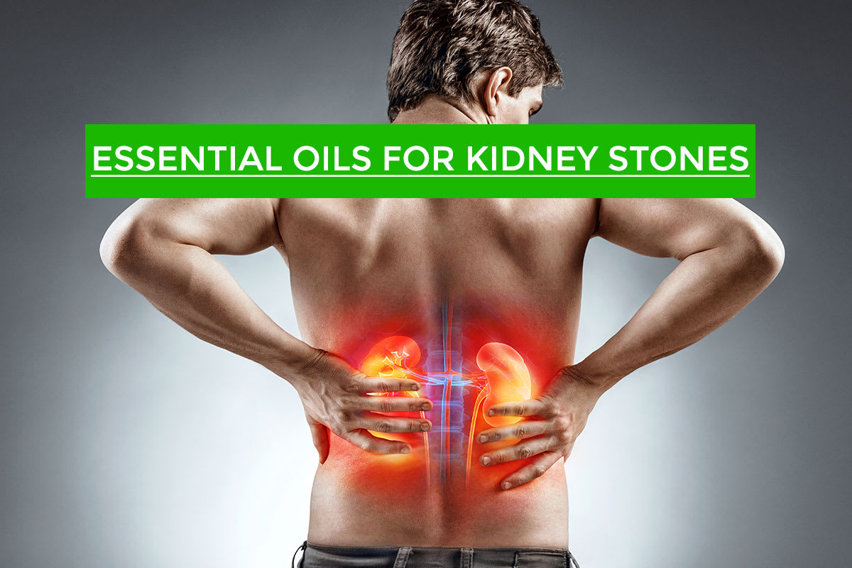 Best 4 Essential Oils for Kidney Stones