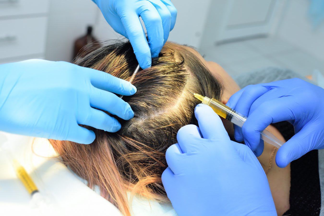 PRP HAIR INJECTION - AnewSkin Aesthetic Clinic and Medical Spa
