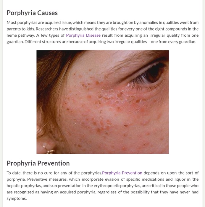Facts About Porphyria Diverse Disease - Herbs Solutions By Nature