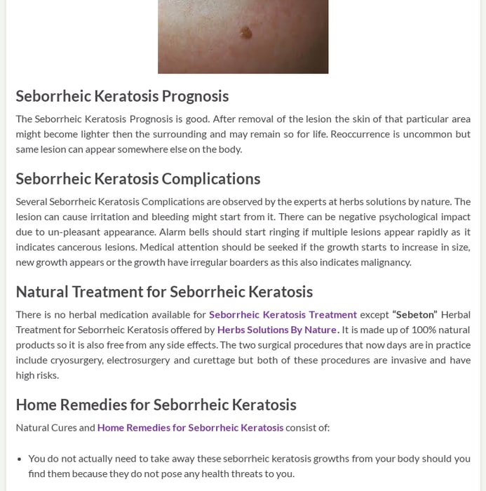 All There Is To Know About Seborrheic Keratosis - Herbs Solutions By Nature