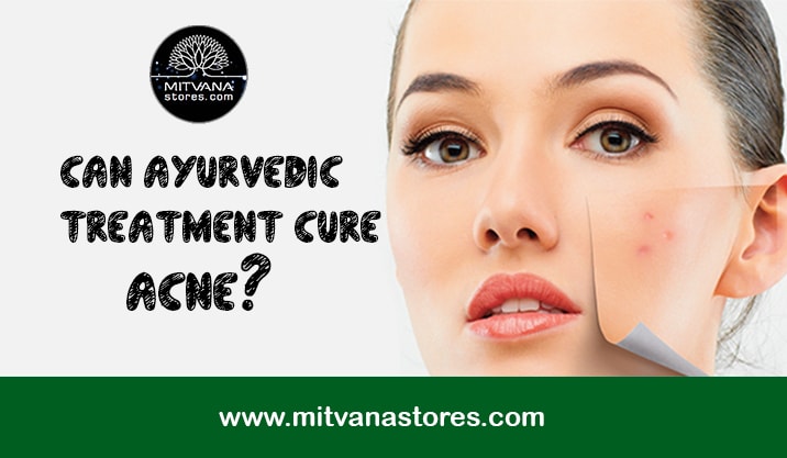 Can Ayurvedic Treatment Cure Acne?