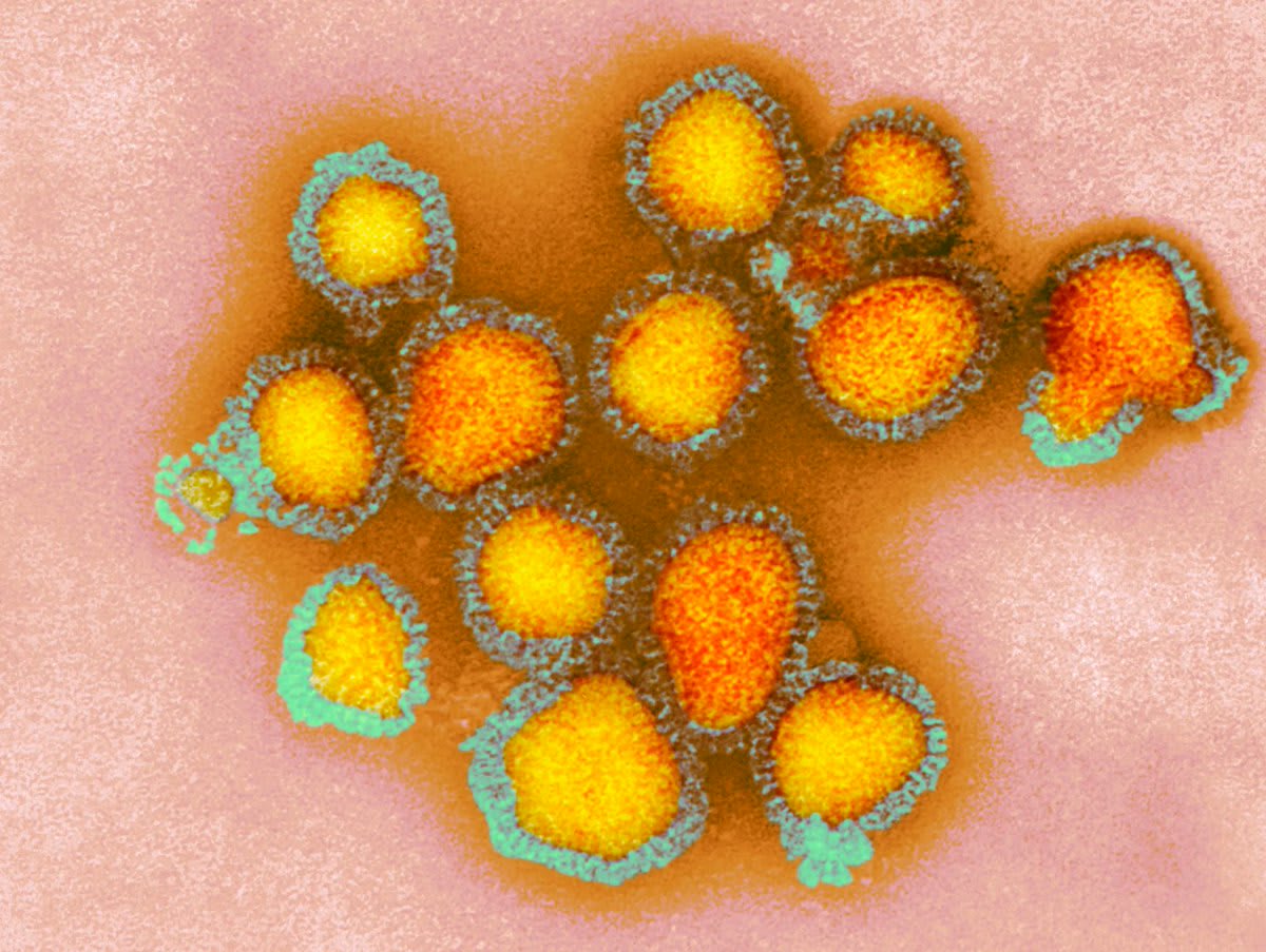 Great news: An mRNA flu vaccine has just delivered positive Phase 1 Trial results! This is a falsely colored transmitted electron micrograph of H3N2, a type of influenza subtype which is normally included in traditional flu vaccines. Read more: