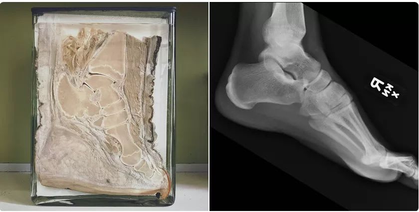 Cross-section X-ray of an elephant foot (L) and human foot (R), showing remarkable similarities.