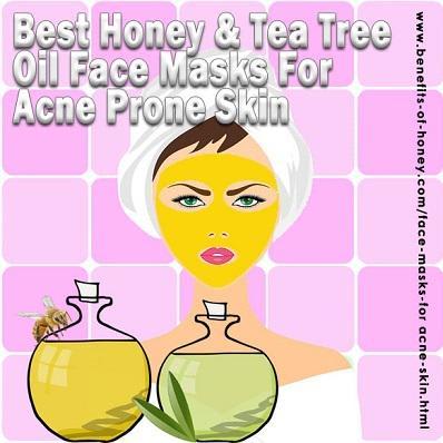 7 Best Honey And Tea Tree Oil Face Masks For Acne Skin