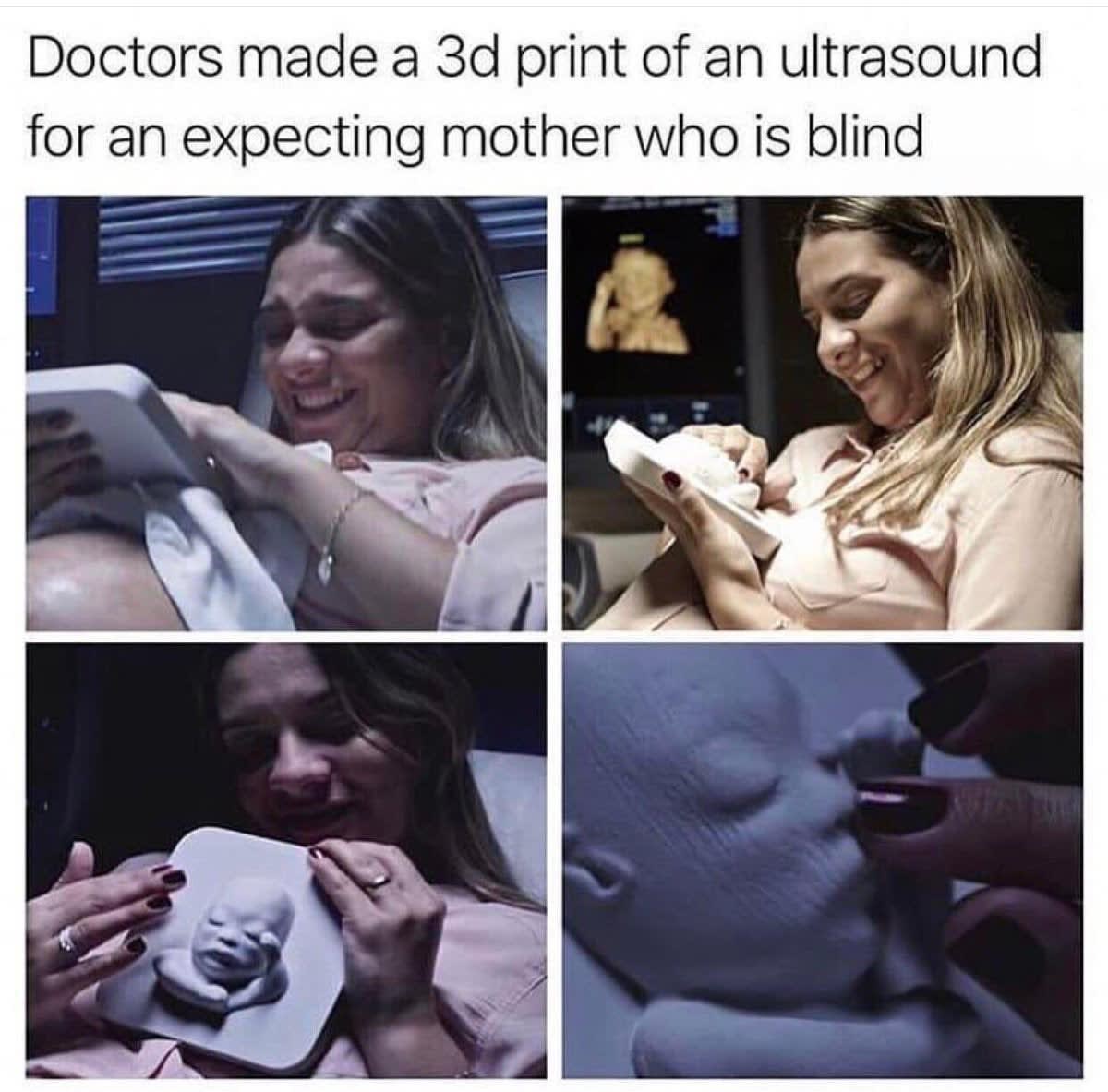 3d printed ultrasound