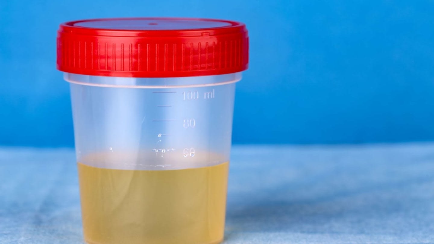 9 Fascinating Facts About Urine