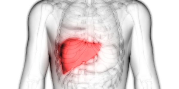Cirrhosis of Liver: What is It, Symptoms & Causes