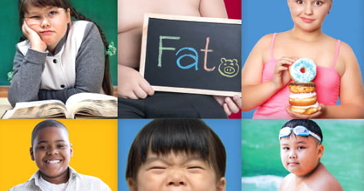Methods of treating obesity in children .