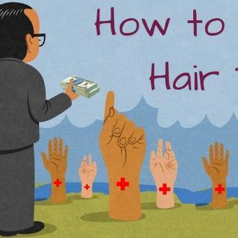 How to Pick Right Hair Transplant Doctor