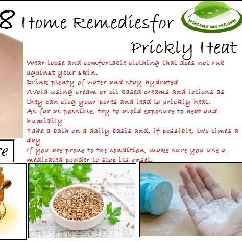 8 Home Remedies for Prickly Heat That Work Rapidly - Herbs Solutions By Nature