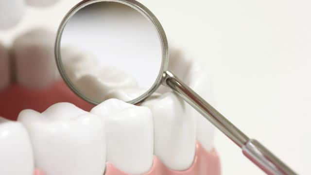 Dental Sealants & Oral Health