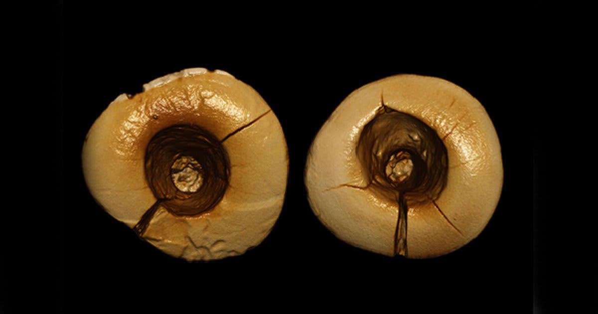 13,000-Year-Old Bitumen Dental Fillings Found in Italy: Earliest Example of Dentistry Known to Date