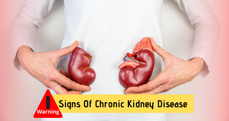 Warning Signs Of Chronic Kidney Disease