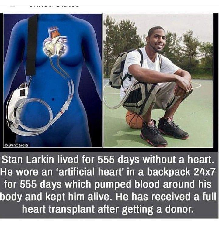 Heartless but not defeated: Man lives without a heart for 555 days