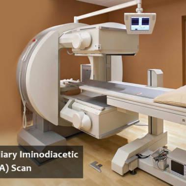 Having a HIDA scan for your gallbladder