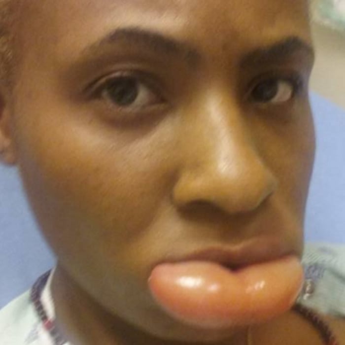 How Lipstick Sent One Woman to the ER