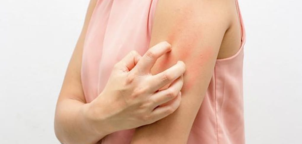 Just Got Diagnosed With Psoriasis? Here’s What You Need To Know