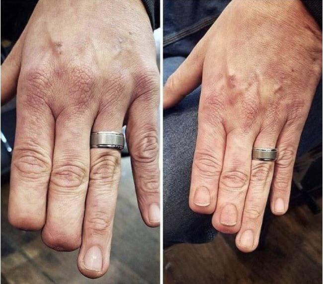 Amazingly well done tattoo to cover up missing fingertips