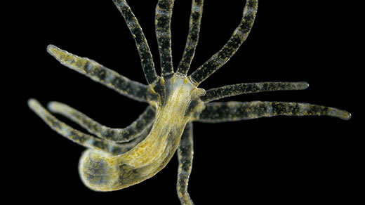 Sleep Evolved Before Brains. Hydras Are Living Proof.