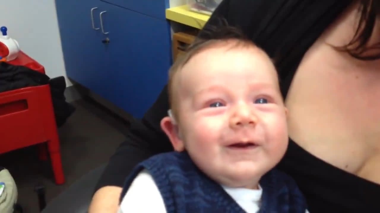 Deaf baby smiles after hearing parents' voices for the first time
