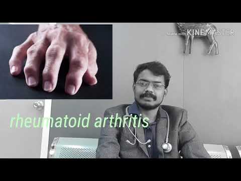 Rheumatoid siddha treatment, Curable treatments in Rheumatoid arthritis