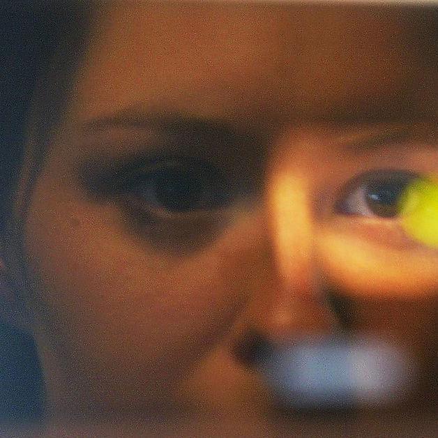 Facial recognition and AI could be used to identify rare genetic disorders