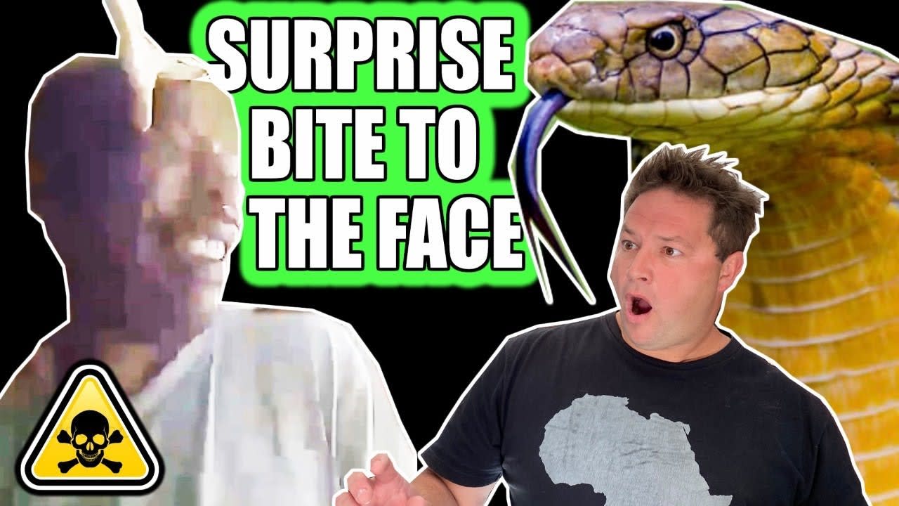 WOW WOW WOW! Snake bites two men in the face!!!!