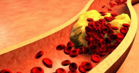 Cholesterol - Nature, Importance, and Disadvantages