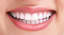 can teeth whitening damage gums - Post Pear - Guest Posting Site