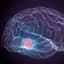What makes aggressive brain cancer 'immortal?'