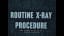 ROUTINE X-RAY PROCEDURE 1940s U.S. NAVY RADIOLOGY TRAINING FILM 53064b