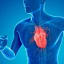 What You Can Do to Prevent a Heart Attack