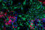 Close-up image of brain cancer cells wins photography prize