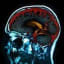 Research Pinpoints Brain's 'Gullibility' Center
