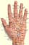 Acupressure Points for the Hands - PositiveMed