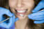 How Often Do You Need a Hygiene Treatment? - Sutherland Shire Dentist