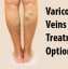 Varicose Veins: Treatment Options to Close off Affected Veins