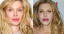 10 Hollywood Celebrities Whose Plastic Surgery Caused Them A Lifetime Embarrassment