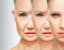 Lifestyle and Health, The Negative Effect of Aging on the Skin